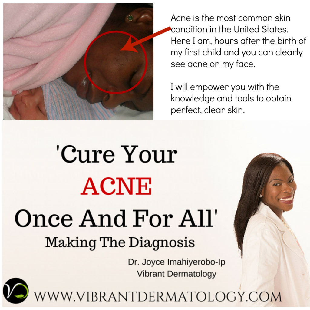 Cure Your Acne Once & For All – Making A Diagnosis - Vibrant