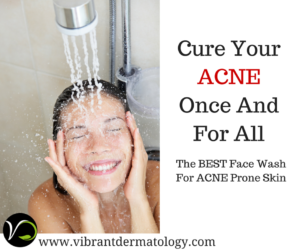 face wash for combination acne prone skin