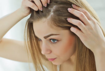 How Do You Treat Hormonal Hair Loss for Women?