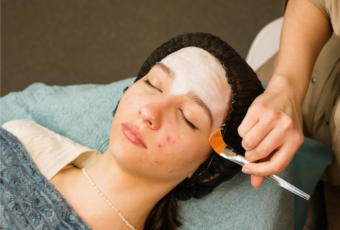 acne treatments Quincy MA