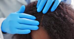 Q & A With the Top-Rated African-American Hair Loss Specialist Serving Newton, MA