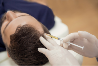 hair loss treatments Lexington Massachusetts
