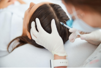 hair loss treatments Somerville MA
