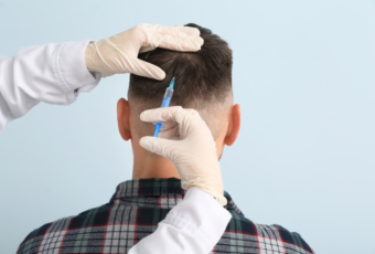 hair restoration techniques near Belmont MA