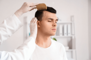 trusted hair loss clinic Medford