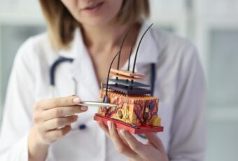 doctor explaining advanced hair loss therapies near Brookline MA