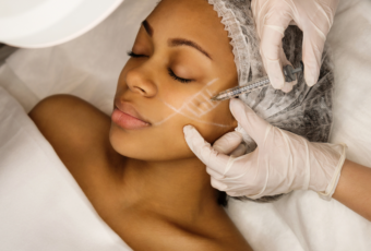 dermal filler treatment Boston