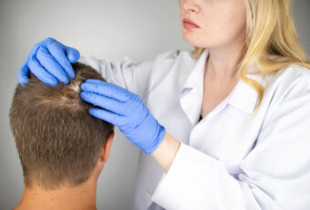 hair loss specialist Norwood MA