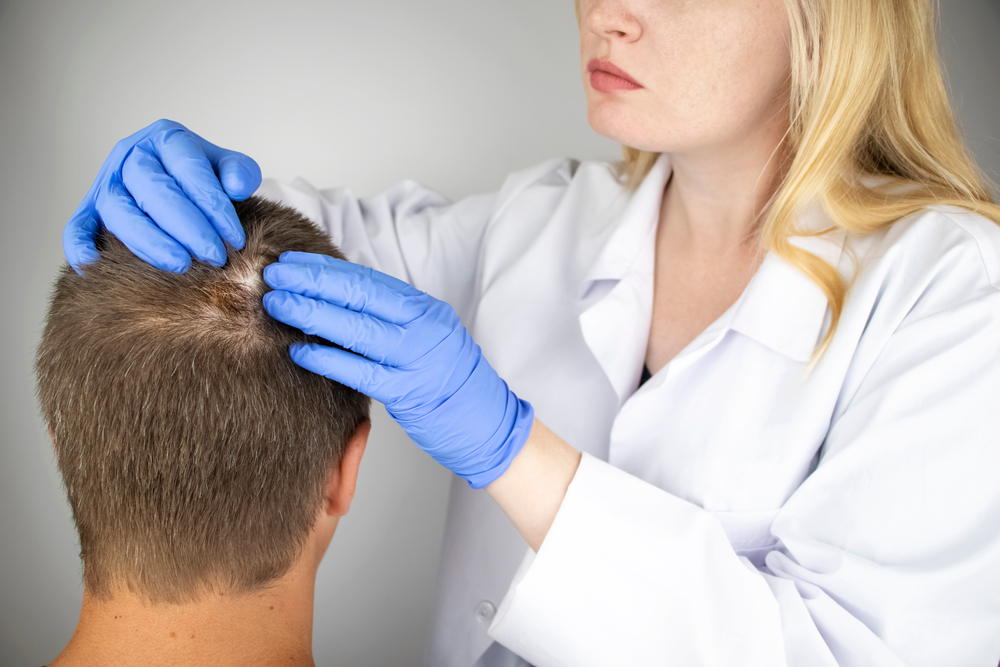 hair loss specialist Norwood MA