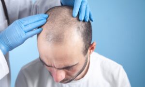 man consulting with a Boston hair loss specialist