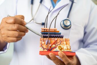 West Roxbury Hair Loss Doctor