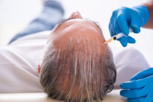 Hair Restoration Treatment Near South Boston