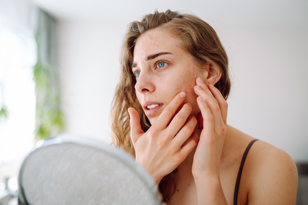 woman with sun-damaged skin near Weymouth MA