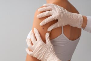 annual skin check Eastern Massachusetts