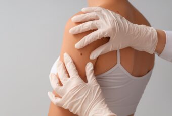 annual skin check Eastern Massachusetts