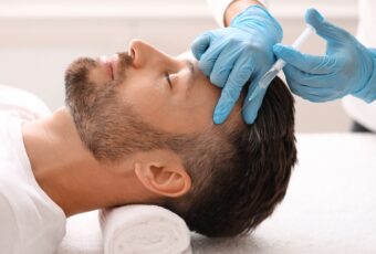 non-surgical hair restoration Boston