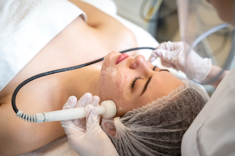 Sofwave non-surgical facelift in Milton MA