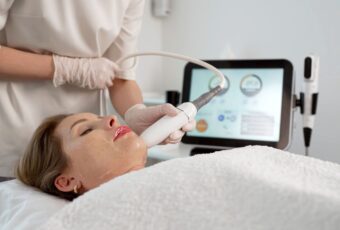 treat fine lines and wrinkles in Milton with Sofwave