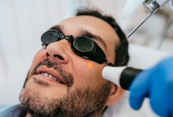 laser resurfacing for acne scars near Boston