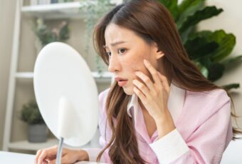 woman in need to treat melasma near Boston