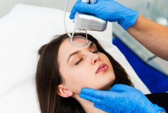 laser acne treatment in 02169 (Quincy, MA)