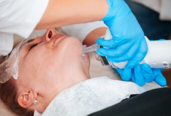 woman stimulating collagen with laser treatments near Boston
