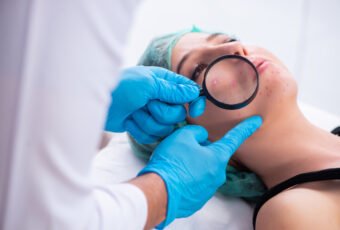 best acne dermatologist Hingham MA