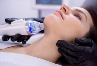 RF microneedling near me in Eastern Massachusetts