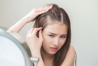 female hair loss in Stoughton MA