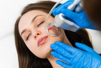 woman getting laser skin resurfacing near Stoughton MA