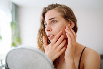 woman with sun-damaged skin near Foxborough MA