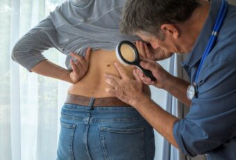 woman getting a new mole looked at
