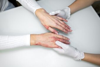 woman wondering if condition looks like eczema or psoriasis