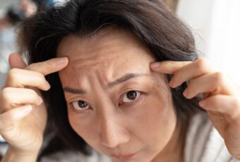 woman wondering if it's time for Botox near Foxborough MA