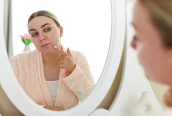 woman with skin breaking out in Acne
